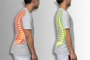 Bad posture and good posture
