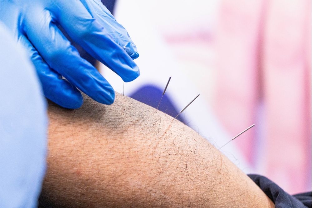 When to Try Physical Therapy Before Considering Surgery