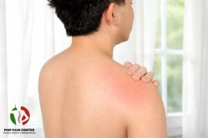 Painful shoulder
